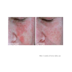 Exuviance Anti Redness Calming Serum