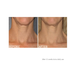 Exuviance Age Reverse Advanced Toning Neck Cream 125 g