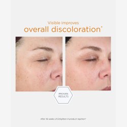 NeoStrata Enlighten Illuminating Serum 30 ml